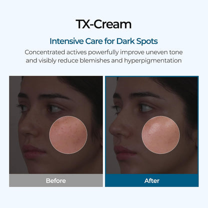 GlowFade™ TX Tranexamic Acid Cream – Korean Anti-Pigmentation & Freckle Corrector for Clear, Even-Toned Skin (50ml)
